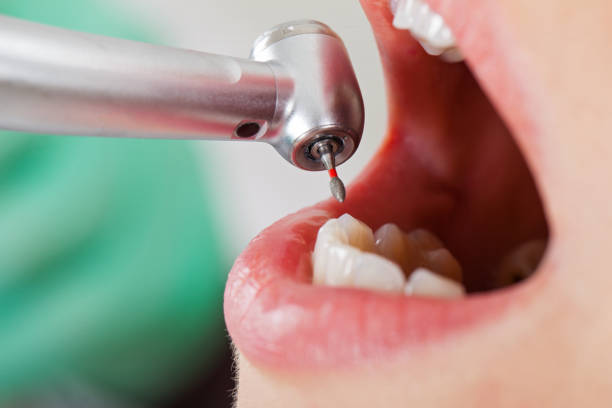 Best Weekend Emergency Dentist in Ocean City, FL